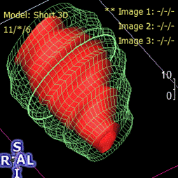 Image shows reconstruction of a baboon heart’s left ventricle from multiple axial magnetic resonance images taken at different part of the cardiac cycle. — Source: Dr. Peter Nathanielsz