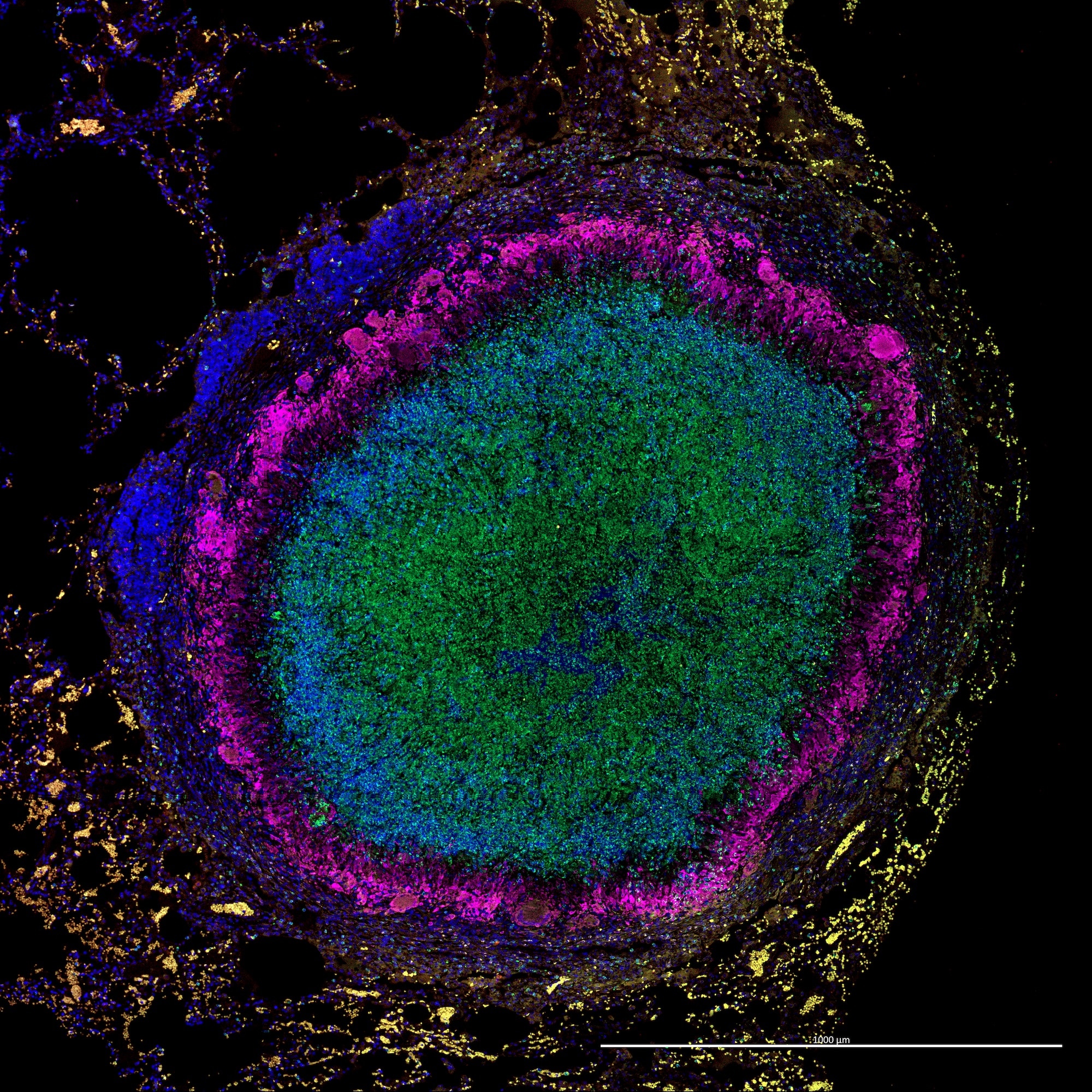 The immune system protein IDO shown in pink