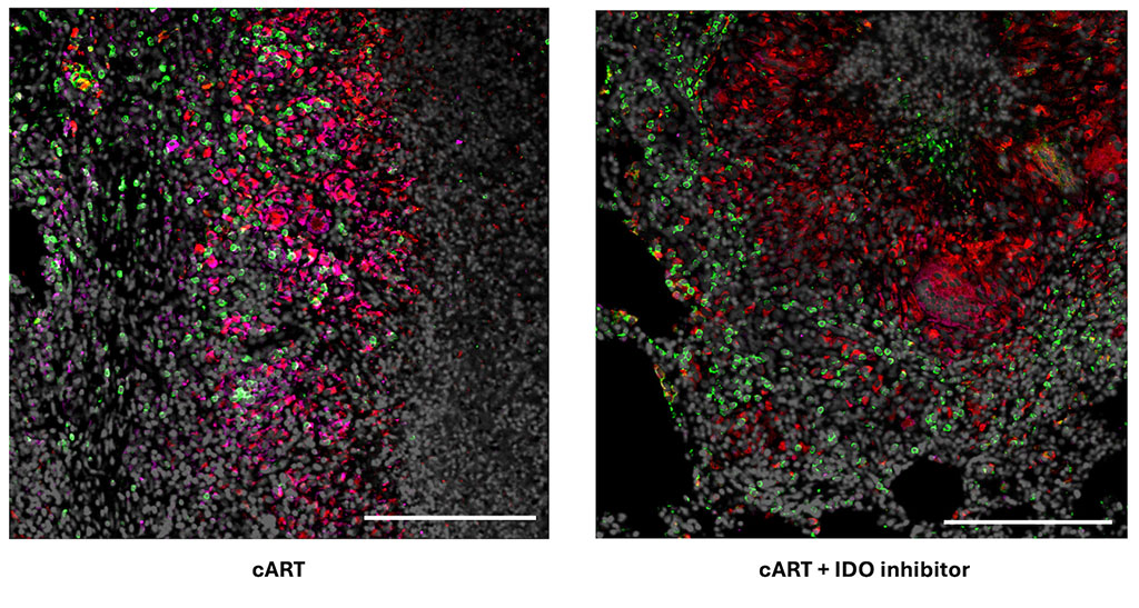 Images of cART and cART + IDO Inhibitor