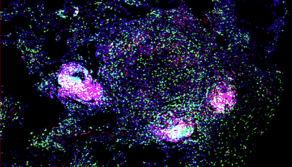 TB vaccine candidate provides ‘elite’ protection