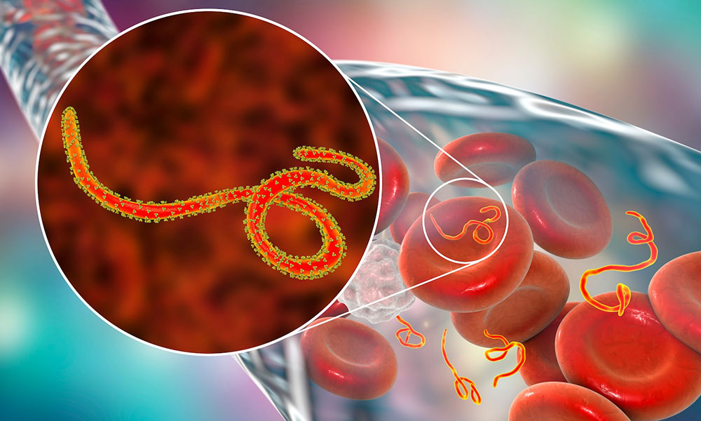 Ebola Virus Graphical Representation