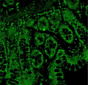 serotonin receptors in the lining of the gut stained in fluorescent green